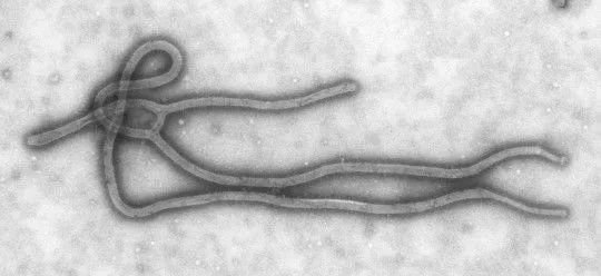 Unis dit de se préparer à Ebola